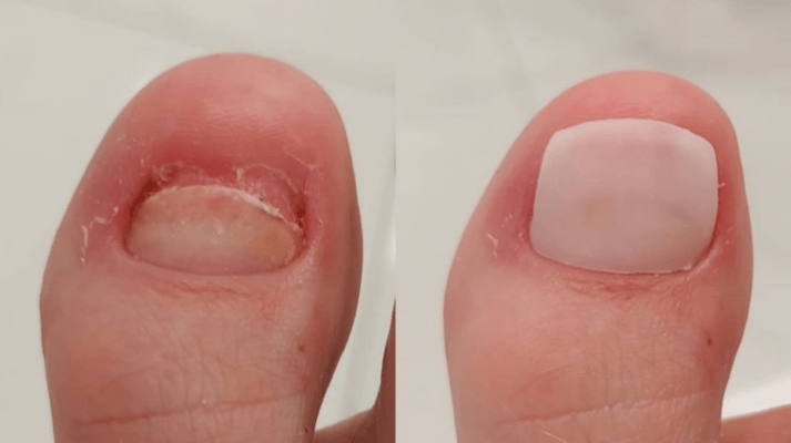 Nagelprothetik Berlin
