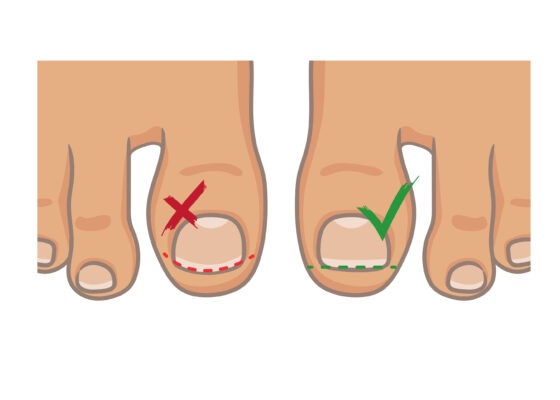 der perfekte nagelschnitt