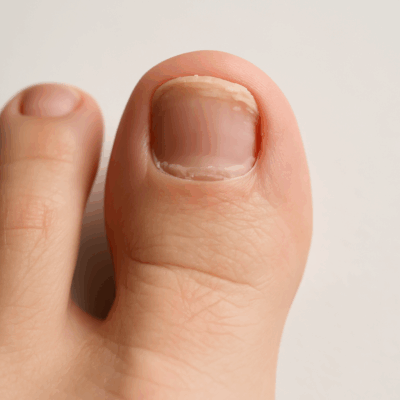 zehennagel wächst nicht mehr nach