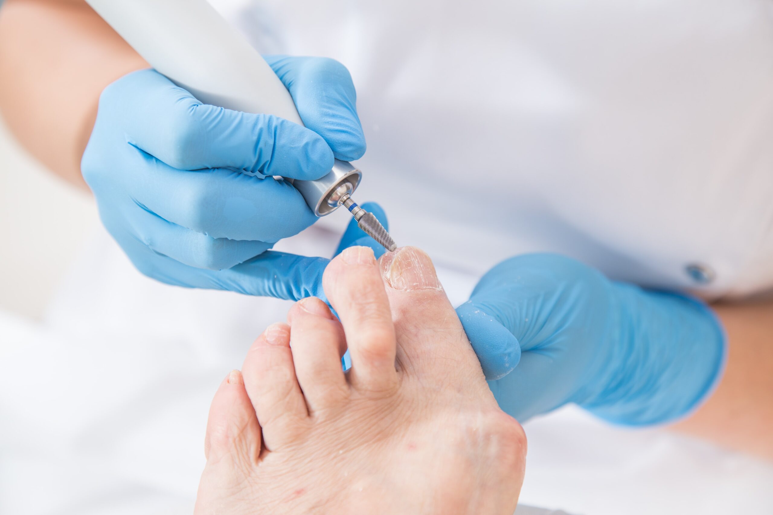 Podologische Komplexbehandlung