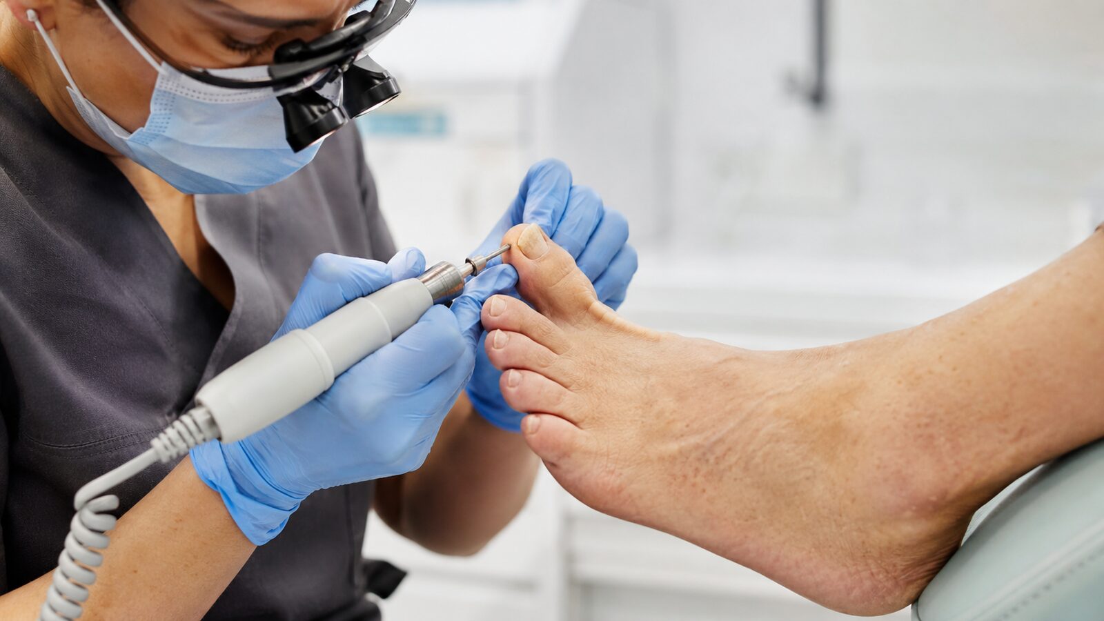 Nagelprobe zur Abklärung deformierter Fußnägel