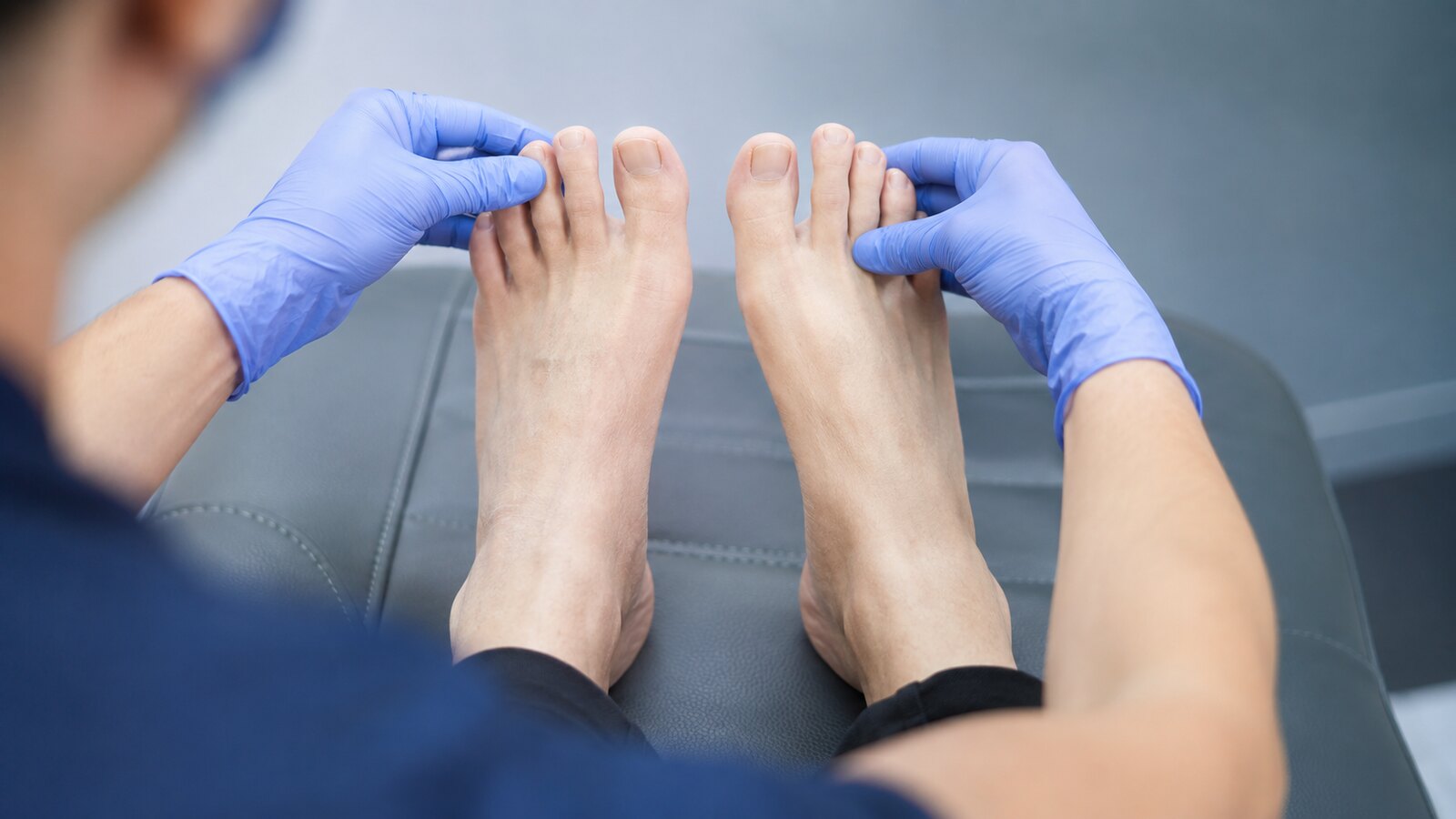 Sorgfältige Kontrolle der Zehen bei Sklerodermie und Raynaud