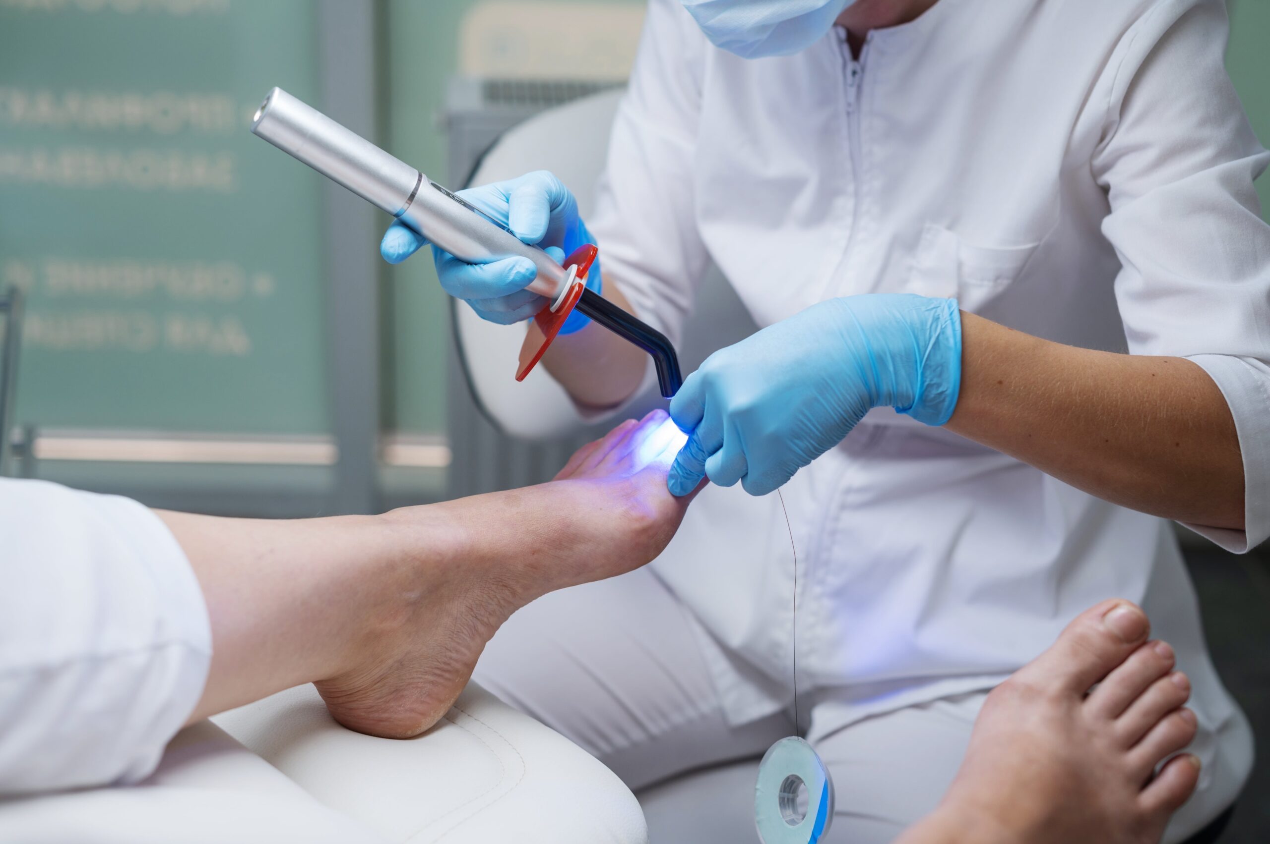 Nagelpilzbehandlung Plasmatherapie